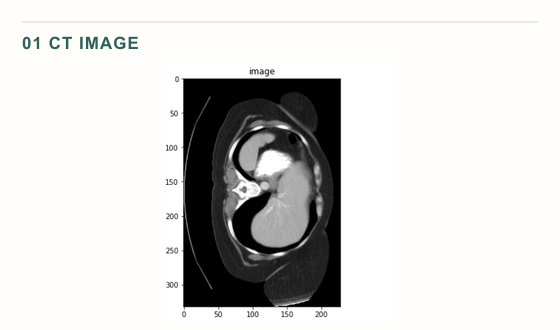 One documented validation CT slice shown in sequence as the input image, reference segmentation, and model prediction.